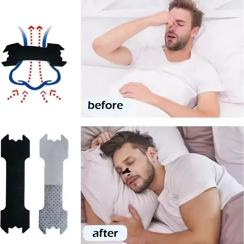 Ventizen Nasal Breathing Strips